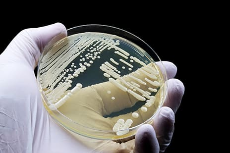 Problemas en la preparaci&oacute;n del medio de cultivo - Scharlab Web Corporativa