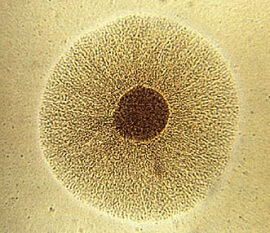 Анализ на микоплазму хоминис (Mycoplasma hominis) в Челябинске